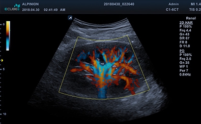 Directional Power Doppler Imaging