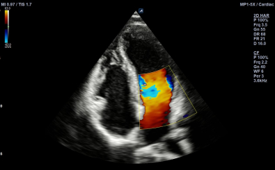 Cardiac