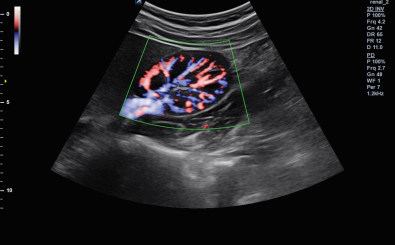 Directional Power Doppler Imaging