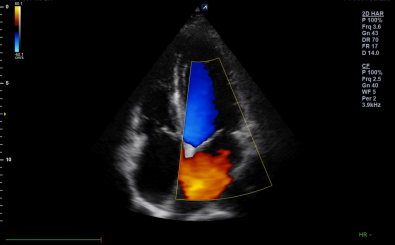 Cardiac