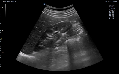 Kidney